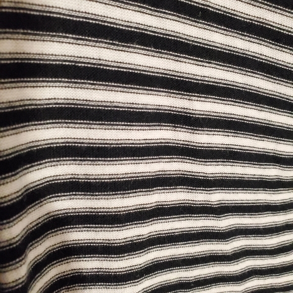 WE the Free Striped Dress with Open Back Detail - Picture 2 of 8